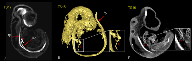 abnormal notochord in adriamycin treated embryos
